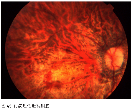 ZY016_241_2.gif